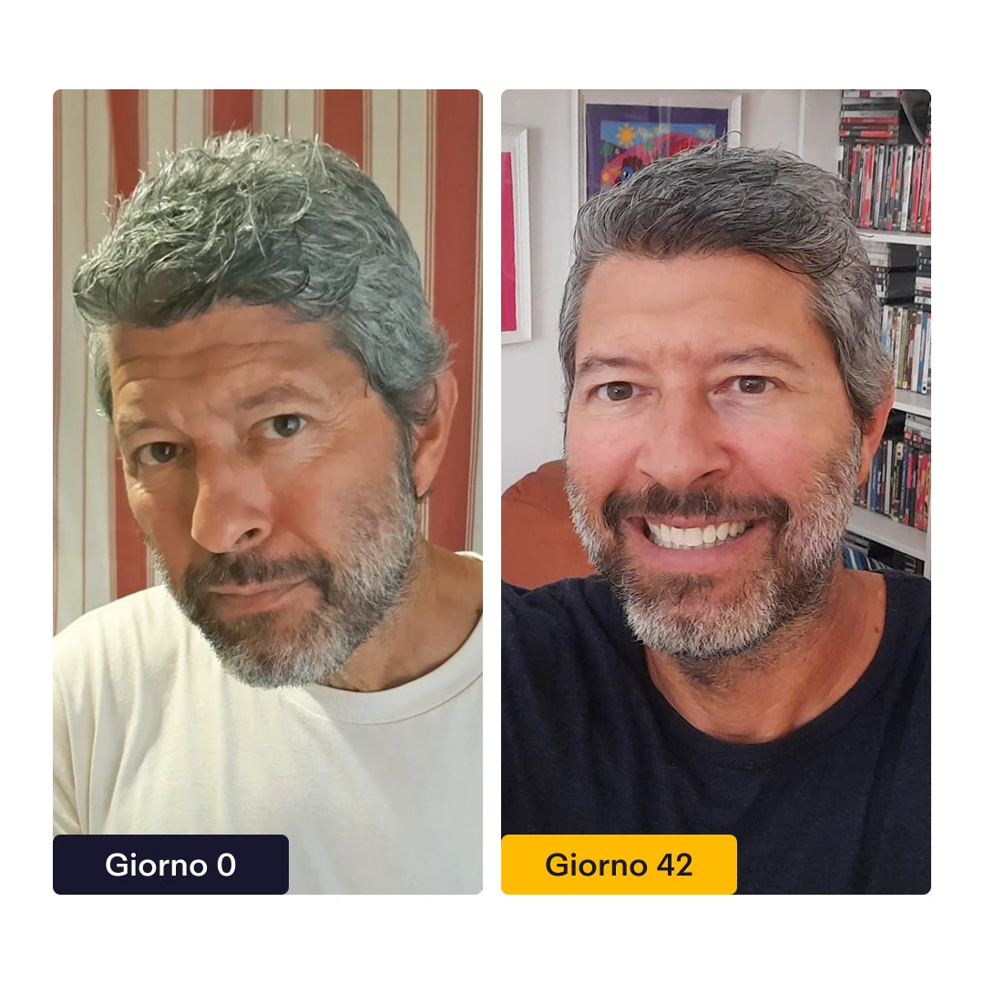 Crema Viso Notte Anti-Età | 100% Made In Italy 🇮🇹